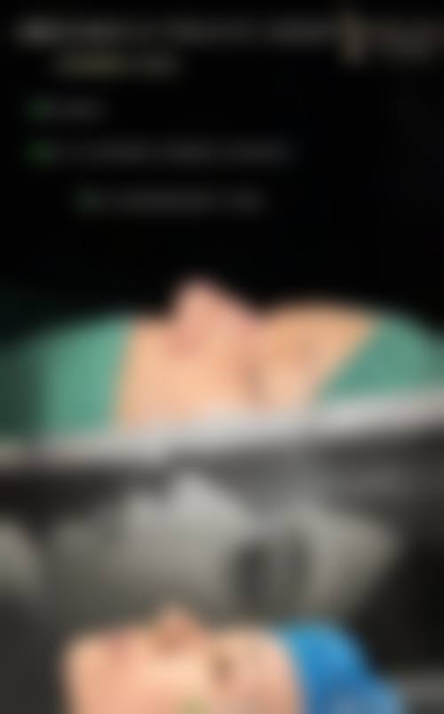 八、山东潍坊瑞昱美整形医院真实的患者评价