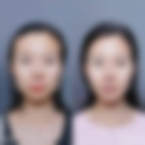 九、台州温岭美辰医疗美容医院真实的患者评价