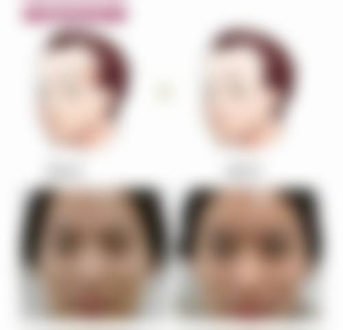 四、呼和浩特任丽医疗美容诊所特色项目