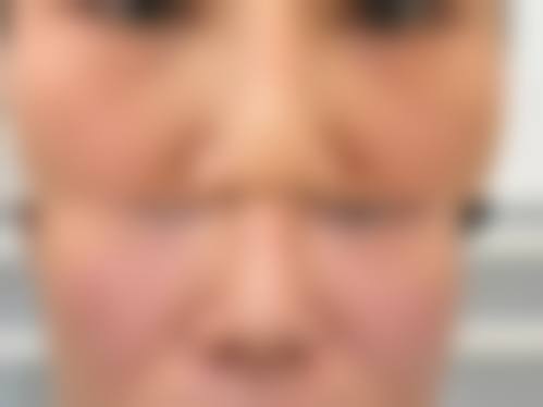 五、长沙安吉娜医疗美容门诊部价格表