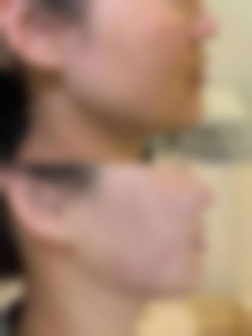 四、北京煤医整形医院特色项目