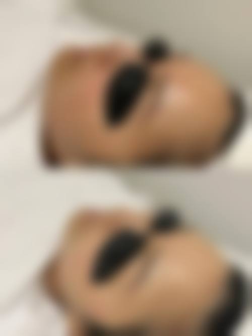 五、宁波尚美整形美容诊所价格表