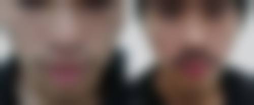 四、长沙梵汐医疗美容特色项目