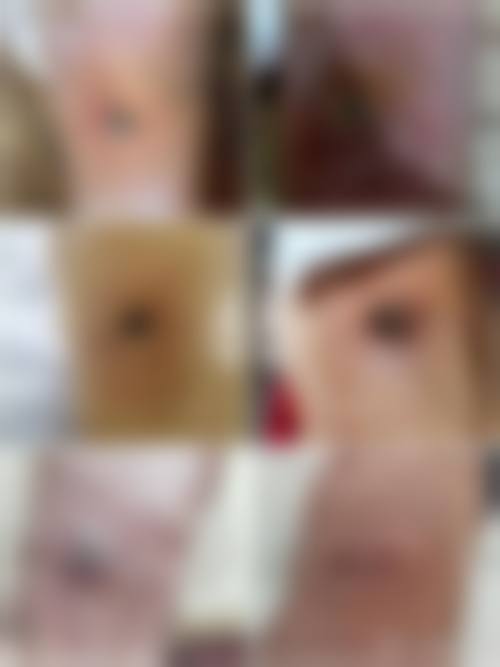 三、汕头爱黛莎医疗美容门诊部诊疗项目有哪些？