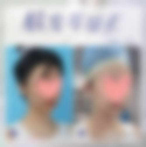 二、滕州艺美整形医院怎么样？