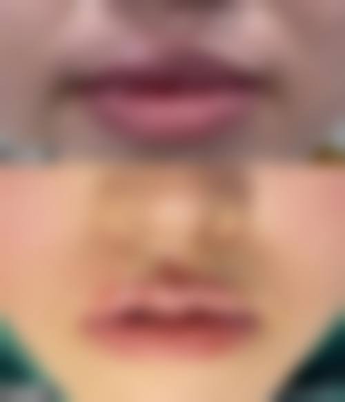 九、汕头爱黛莎医疗美容门诊部真实的患者评价