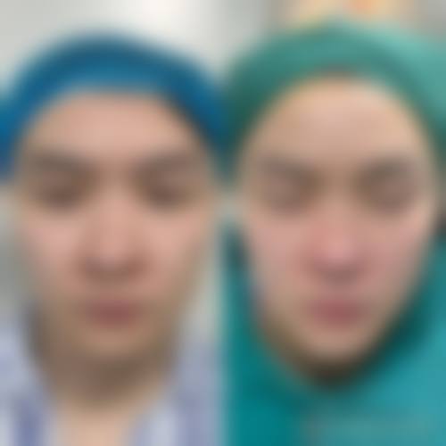 八、江苏省人民医院（整形外科）真实的患者评价