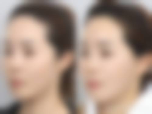 四、北京东方瑞丽尚品整形美容医院特色项目