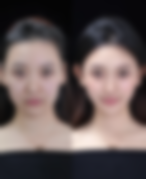 六、疤痕增生的日常护理