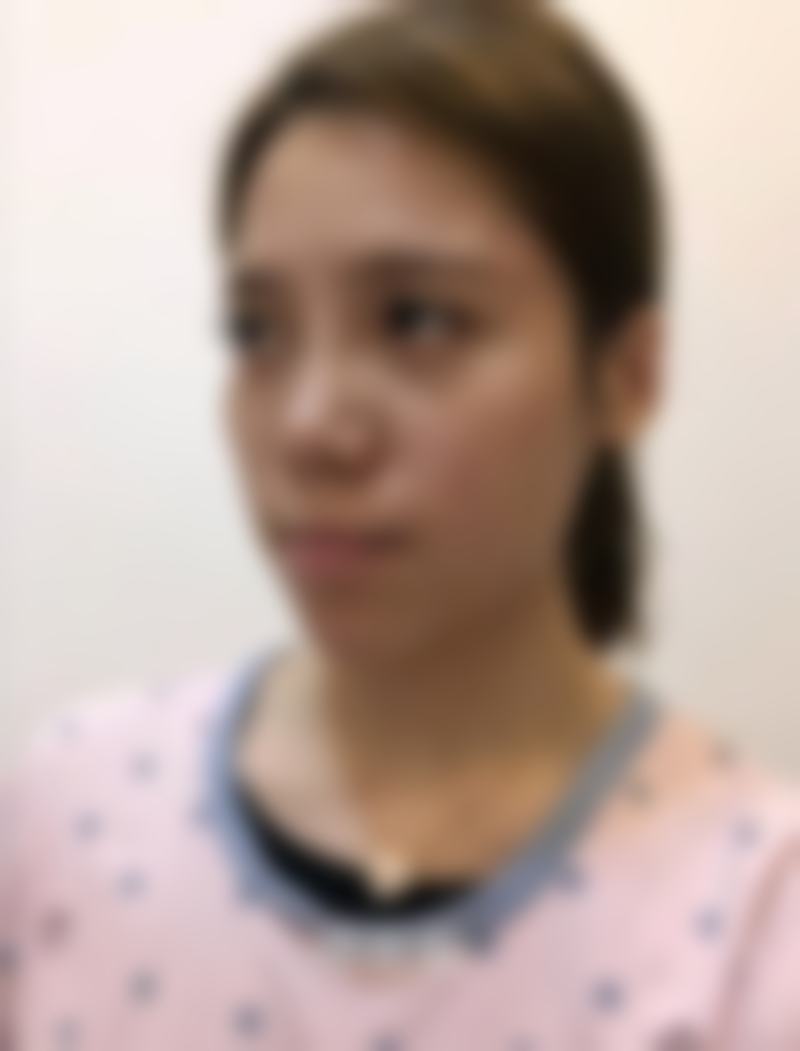 四、术后成效见证