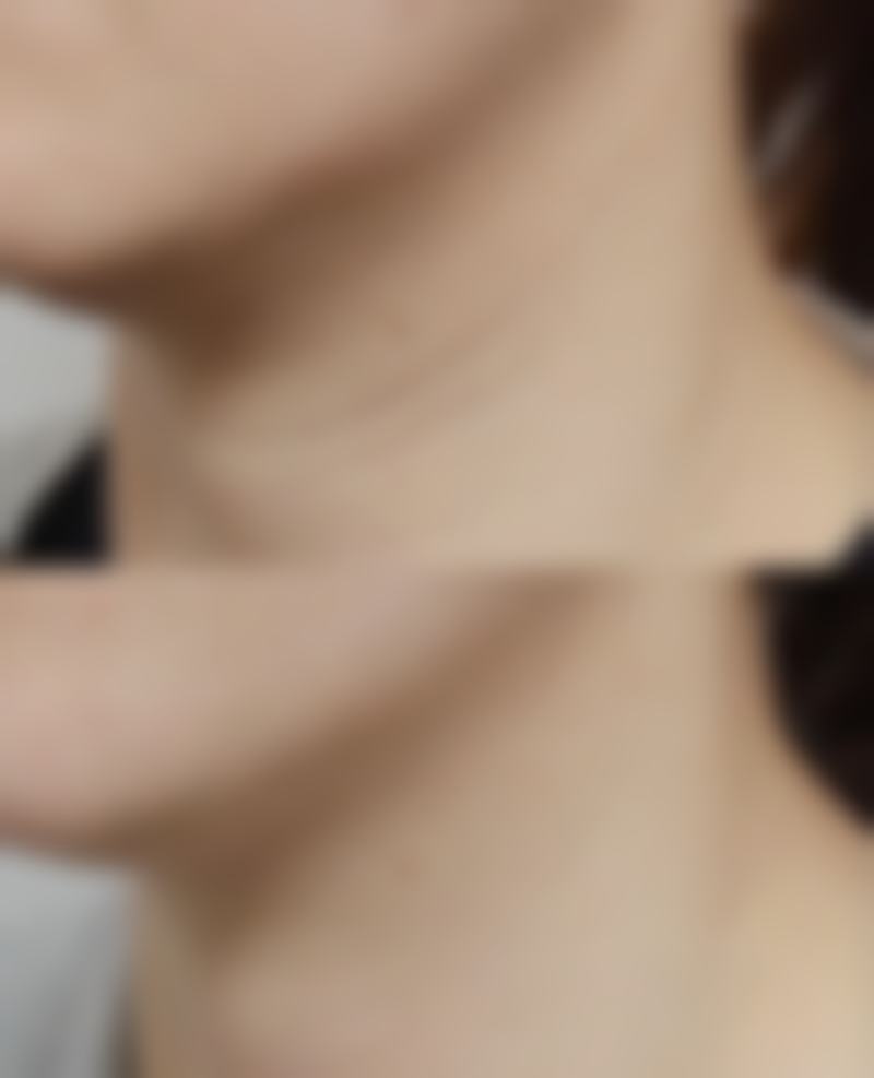 四、滕州艺美整形医院特色项目