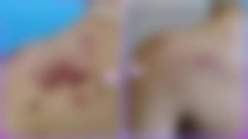 二、郑州美贝医疗美容医院怎么样？