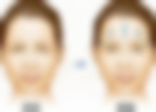 私人工作室打瘦脸针安全吗可靠吗？多起事故敲响警钟，正规机构才是首选 