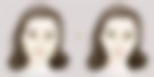 四、如何判断硅胶隆鼻是否有穿透鼻尖的风险