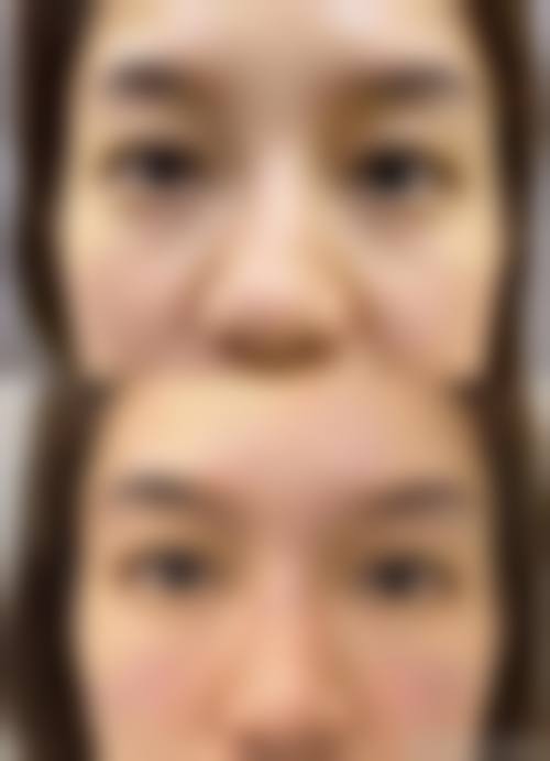 四、济宁北医圣心医疗美容诊所特色项目