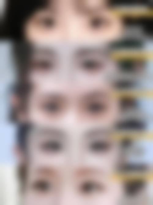 六、西安至尚（索米奥）医疗美容门诊部价格表