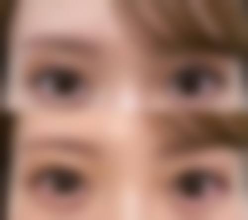 九、西安至尚（索米奥）医疗美容门诊部真实的患者评价