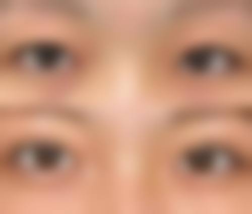 四、西安至尚（索米奥）医疗美容门诊部特色项目