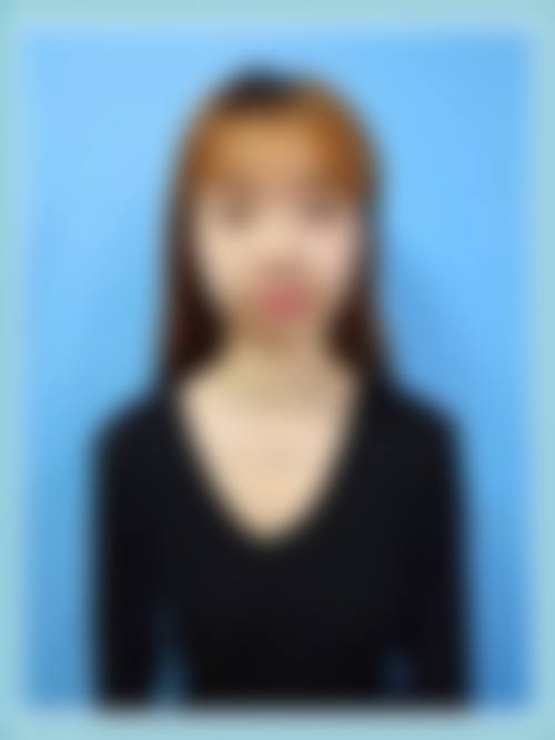 九、乌鲁木齐艾美整形门诊部真实的患者评价