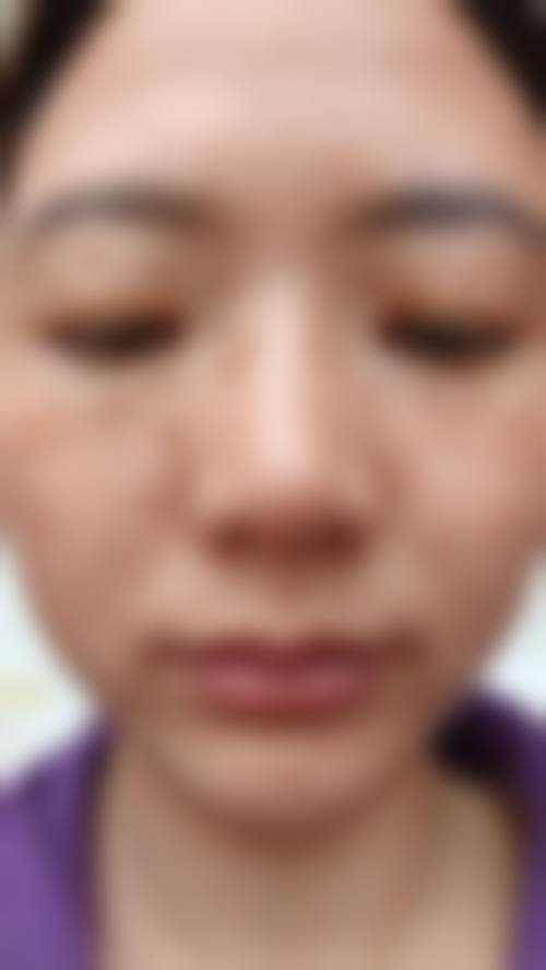 四、武汉美莱整形医疗美容医院特色项目