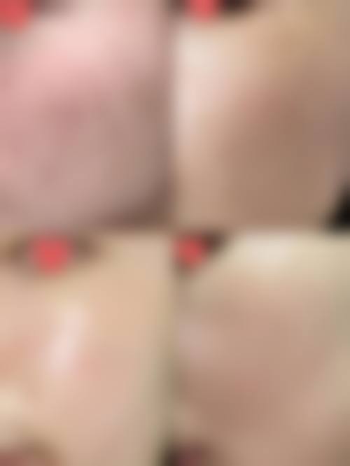 四、温州铂妍医疗美容诊所特色项目