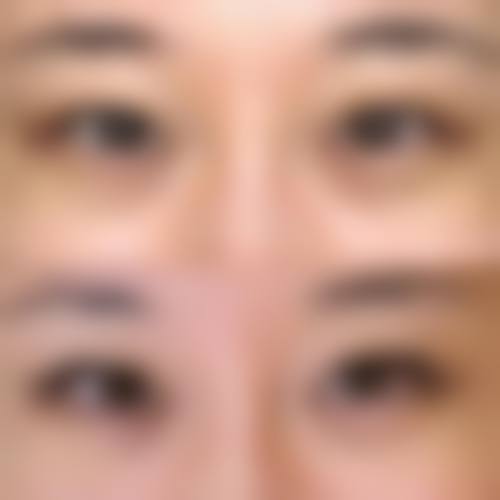 九、江西吉安馨颜整形真实的患者评价