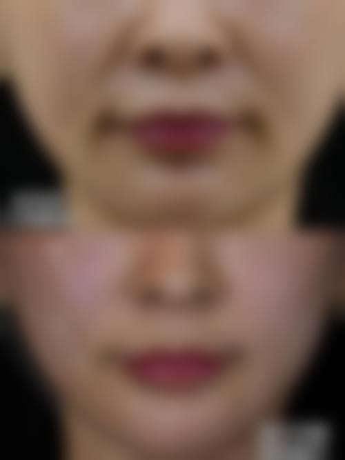 八、郑州尚恩医疗美容诊所真实的患者评价