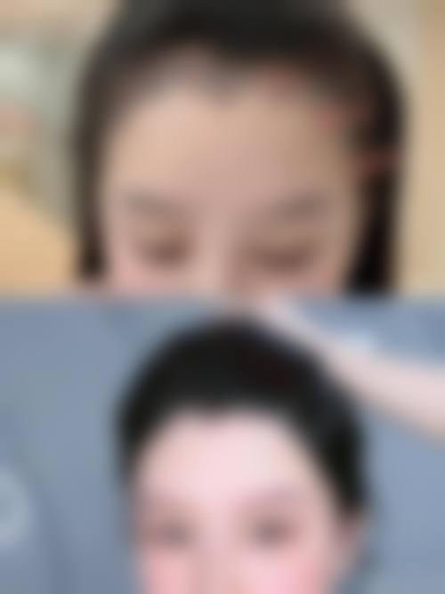 四、怀化德美整形美容门诊部特色项目