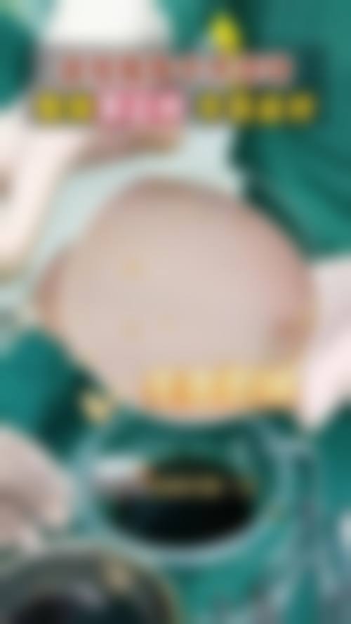 九、济宁北医圣心医疗美容诊所真实的患者评价