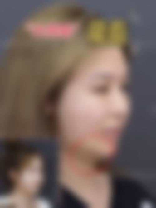 九、海南海口七芝敏整形医院真实的患者评价