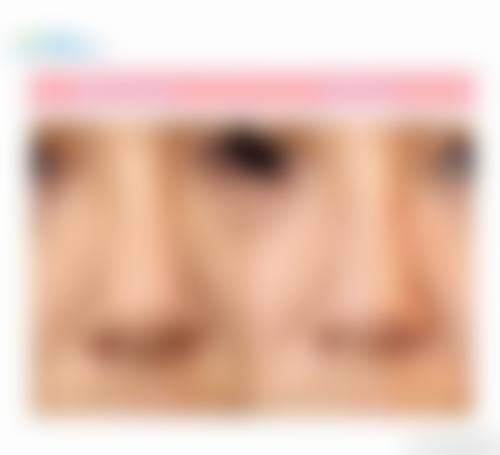 九、武汉美莱整形医疗美容医院真实的患者评价