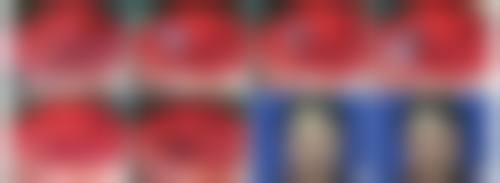 九、温州铂妍医疗美容诊所真实的患者评价