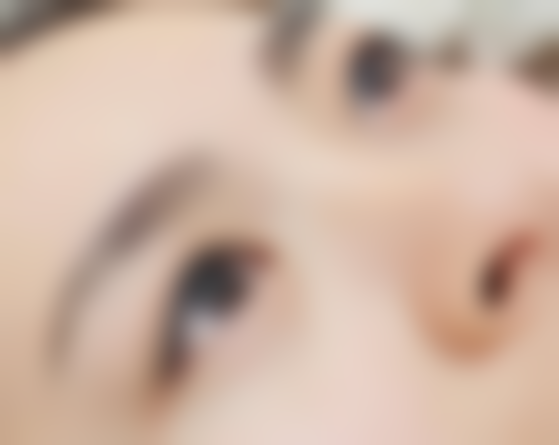 一、三十六岁眼部状况分析