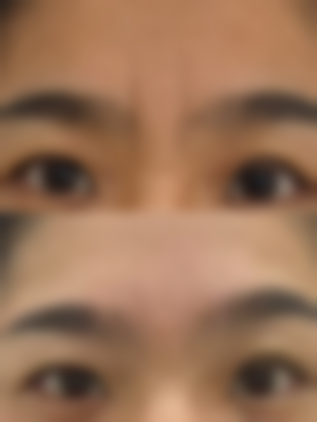 二、江西吉安馨颜整形怎么样？