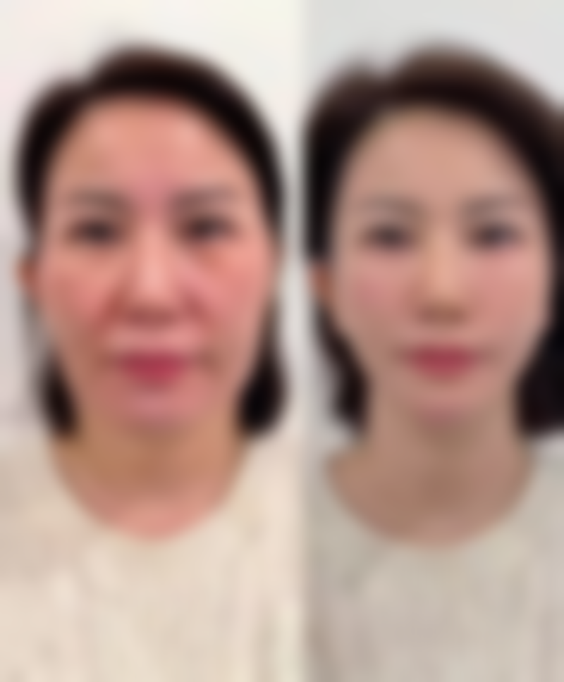 二、荔湾恬媄·健康轻医美整形怎么样？