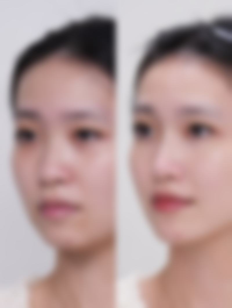 八、福州台江时匠医疗美容门诊部真实的患者评价