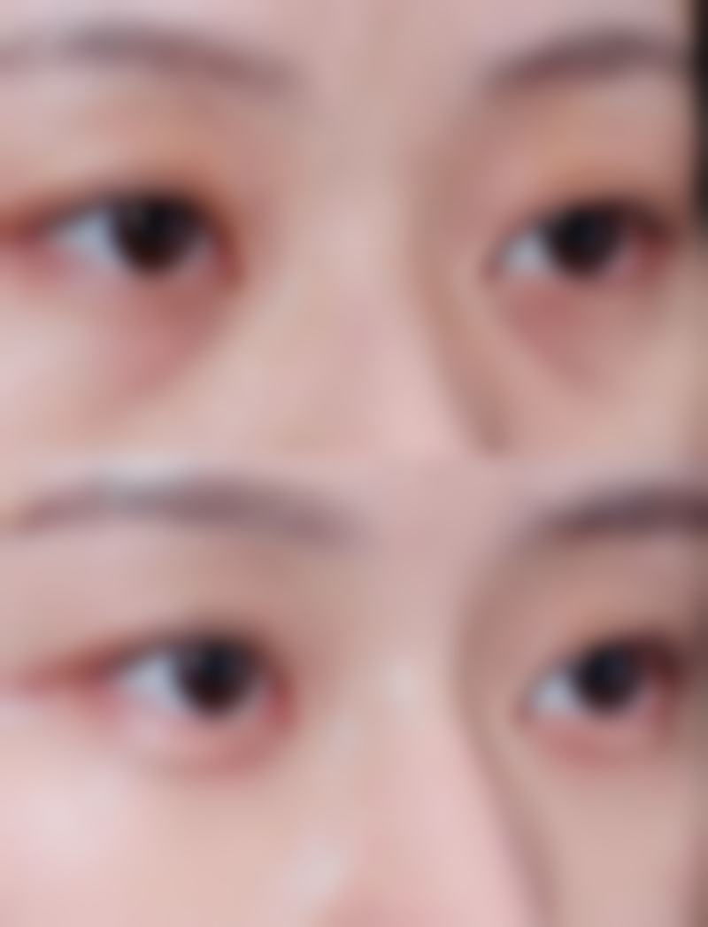 九、广州姬振翔整形医院真实的患者评价