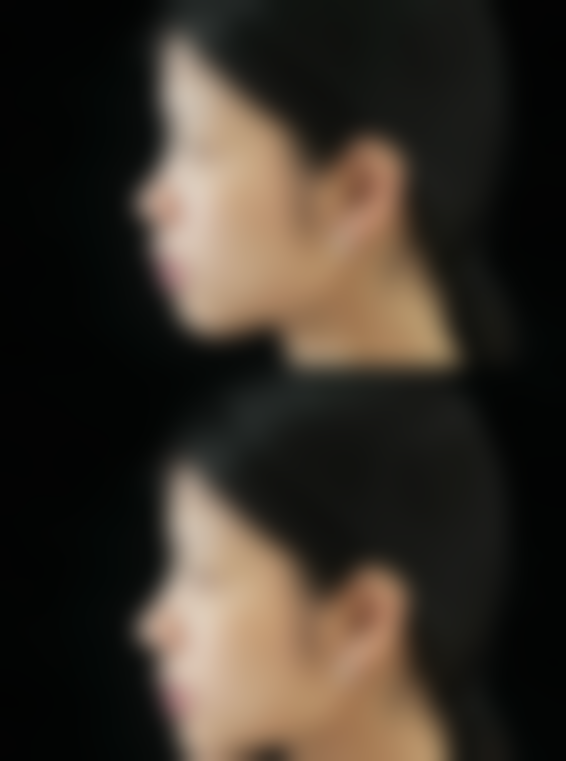 六、江西吉安馨颜整形价格表