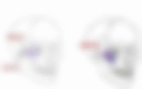 二、不同类型眼袋下眼部按摩仪的成效分析