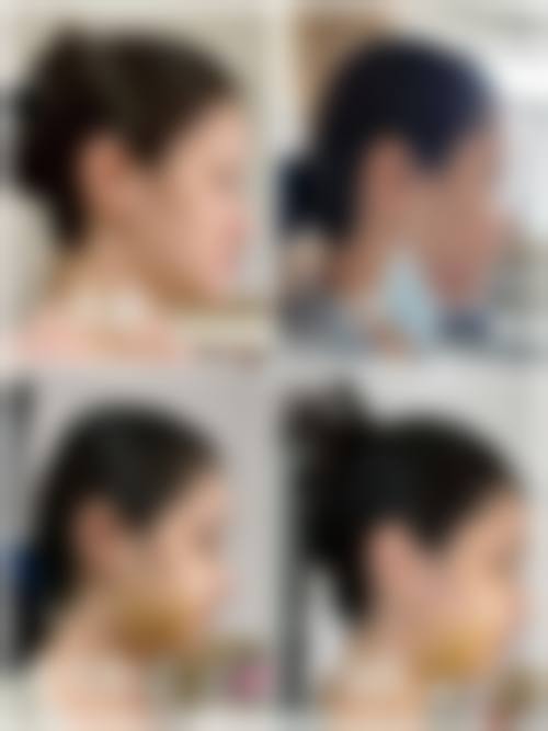 二、沈阳汇美人医疗美容先农坛路医疗美容诊所怎么样？