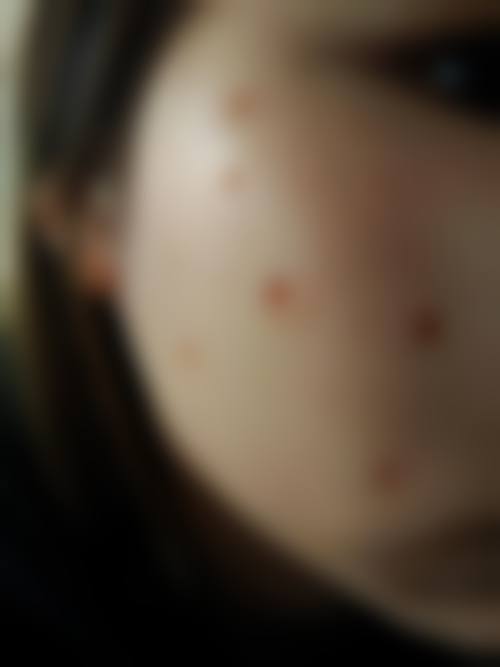 五、VN整形外科医院价格表