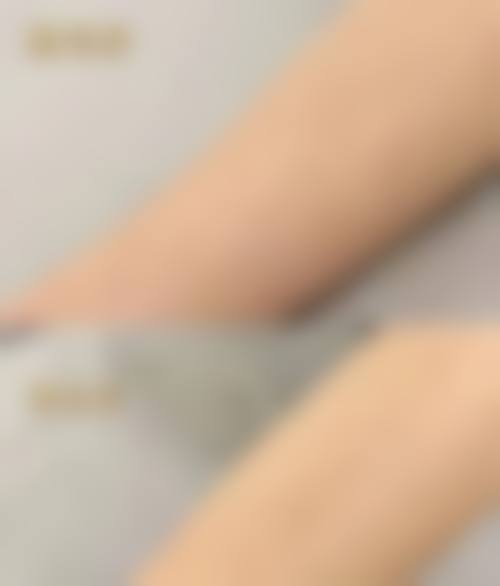 八、霸州优嘉整形医院真实的患者评价