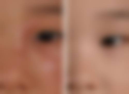 九、吉林林燕整形医疗美容诊所真实的患者评价