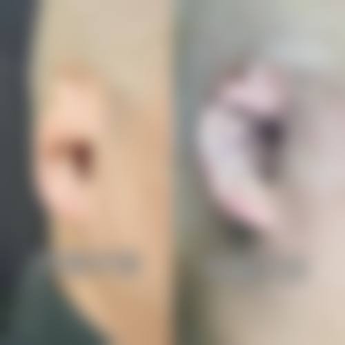 四、武汉奇佶抗衰医疗美容诊所特色项目