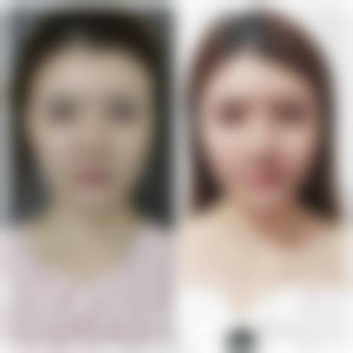 八、恩施可素美整形医院真实的患者评价