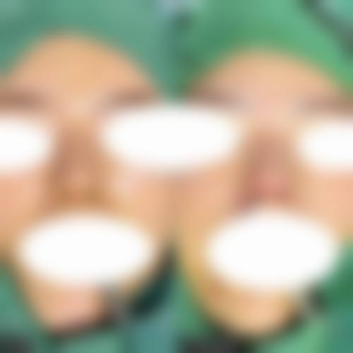 五、恩施可素美整形医院价格表