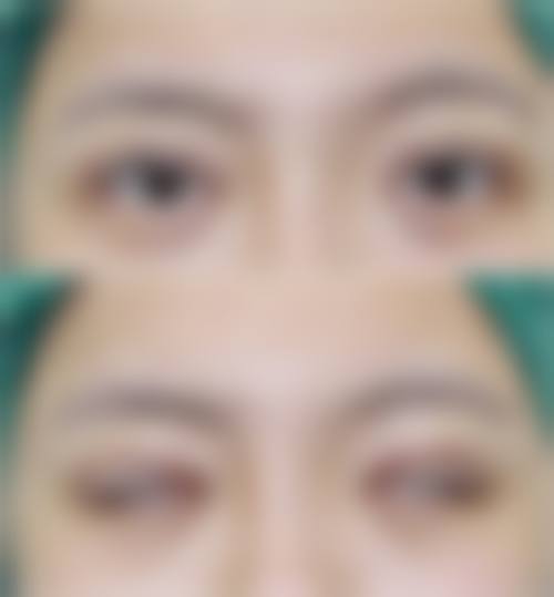 四、武汉西婵医疗美容门诊部特色项目