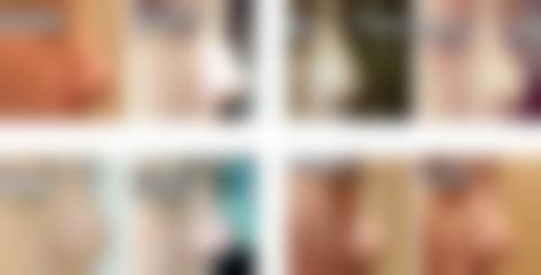 七、韩国will整形外科医院预约方式