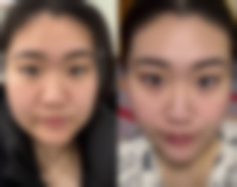 七、余姚惠爱医院整形整容外科预约方式