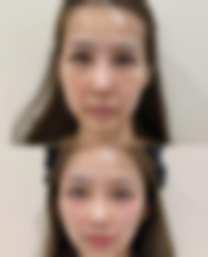 六、青岛市黄岛区中医医院整形美容科地址及交通